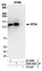KIF5A antibody, A304-343A, Bethyl Labs, Immunoprecipitation image 