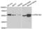ATPase H+ Transporting V1 Subunit B1 antibody, LS-C348977, Lifespan Biosciences, Western Blot image 