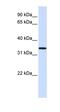 Chromosome 16 Open Reading Frame 78 antibody, orb325773, Biorbyt, Western Blot image 