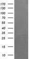 Armadillo Repeat Containing 1 antibody, M14427, Boster Biological Technology, Western Blot image 