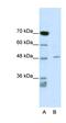 Calcium Voltage-Gated Channel Auxiliary Subunit Beta 4 antibody, orb324585, Biorbyt, Western Blot image 