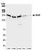 BLM RecQ Like Helicase antibody, NB100-214, Novus Biologicals, Western Blot image 