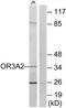 Olfactory Receptor Family 3 Subfamily A Member 2 antibody, TA314308, Origene, Western Blot image 