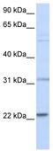 Cell Division Cycle 42 antibody, TA330323, Origene, Western Blot image 