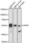 RNA Guanine-7 Methyltransferase antibody, A07752, Boster Biological Technology, Western Blot image 