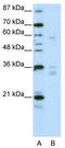 Zinc Finger Protein 440 antibody, TA345539, Origene, Western Blot image 
