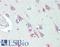 Glucosylceramidase Beta antibody, LS-B15837, Lifespan Biosciences, Immunohistochemistry paraffin image 