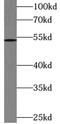 DAX1 antibody, FNab02248, FineTest, Western Blot image 