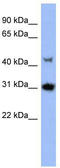 Serine/threonine-protein kinase PRKY antibody, TA342154, Origene, Western Blot image 
