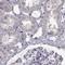 Armadillo Repeat Containing 3 antibody, NBP1-85394, Novus Biologicals, Immunohistochemistry paraffin image 