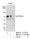 DDB1 And CUL4 Associated Factor 8 antibody, NB100-77300, Novus Biologicals, Western Blot image 