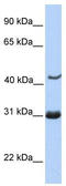 Nucleoporin 35 antibody, TA340280, Origene, Western Blot image 