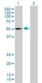 Vasoactive Intestinal Peptide Receptor 1 antibody, H00007433-B01P, Novus Biologicals, Western Blot image 