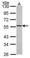 Islet Cell Autoantigen 1 antibody, PA5-30066, Invitrogen Antibodies, Western Blot image 
