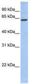 Deuterosome Assembly Protein 1 antibody, TA337586, Origene, Western Blot image 