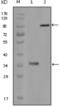 HCK Proto-Oncogene, Src Family Tyrosine Kinase antibody, abx011842, Abbexa, Enzyme Linked Immunosorbent Assay image 