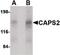 Calcium-dependent secretion activator 2 antibody, PA5-20518, Invitrogen Antibodies, Western Blot image 