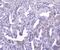 Glutathione S-Transferase Mu 1 antibody, M00569, Boster Biological Technology, Immunohistochemistry paraffin image 