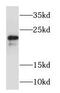 RAB22A, Member RAS Oncogene Family antibody, FNab07004, FineTest, Western Blot image 