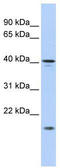 SLAIN Motif Family Member 1 antibody, TA340332, Origene, Western Blot image 