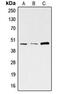 S-Phase Kinase Associated Protein 2 antibody, MBS820991, MyBioSource, Western Blot image 