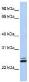 TIP27 antibody, TA341526, Origene, Western Blot image 