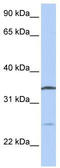 OCIA Domain Containing 1 antibody, TA346628, Origene, Western Blot image 