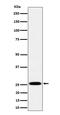 Indolethylamine N-Methyltransferase antibody, M09175, Boster Biological Technology, Western Blot image 