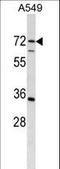 Cytidine And DCMP Deaminase Domain Containing 1 antibody, LS-C168579, Lifespan Biosciences, Western Blot image 