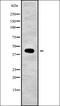Ubiquitin carboxyl-terminal hydrolase 12 antibody, orb338777, Biorbyt, Western Blot image 