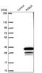 RAB28, Member RAS Oncogene Family antibody, NBP1-92308, Novus Biologicals, Western Blot image 