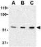 P21 (RAC1) Activated Kinase 2 antibody, GTX31743, GeneTex, Western Blot image 