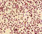 Cyclin Dependent Kinase 4 antibody, A52392-100, Epigentek, Immunohistochemistry paraffin image 