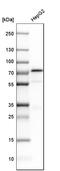 Alpha Fetoprotein antibody, HPA010607, Atlas Antibodies, Western Blot image 