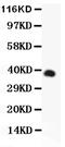 Cd95l antibody, PB9068, Boster Biological Technology, Western Blot image 