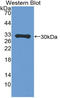 Perforin 1 antibody, LS-B15024, Lifespan Biosciences, Western Blot image 