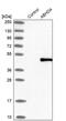 Abhydrolase Domain Containing 4 antibody, PA5-51421, Invitrogen Antibodies, Western Blot image 