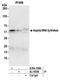 Aspartyl-tRNA synthetase, cytoplasmic antibody, A304-799A, Bethyl Labs, Immunoprecipitation image 