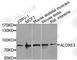 Arachidonate Lipoxygenase 3 antibody, A8245, ABclonal Technology, Western Blot image 