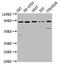 Solute Carrier Family 26 Member 4 antibody, LS-C673140, Lifespan Biosciences, Western Blot image 