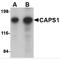 Calcium-dependent secretion activator 1 antibody, 4561, ProSci, Western Blot image 