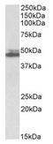 SH3 Domain Containing GRB2 Like 1, Endophilin A2 antibody, AP23746PU-N, Origene, Western Blot image 
