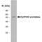 Cytochrome P450 Family 19 Subfamily A Member 1 antibody, MCA2077S, Bio-Rad (formerly AbD Serotec) , Western Blot image 