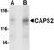 Calcium-dependent secretion activator 2 antibody, orb74976, Biorbyt, Western Blot image 