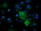 Cytoplasmic dynein 1 light intermediate chain 1 antibody, TA501510, Origene, Immunofluorescence image 