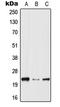 Hematopoietic Prostaglandin D Synthase antibody, LS-C353399, Lifespan Biosciences, Western Blot image 