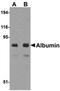 Albumin antibody, orb75197, Biorbyt, Western Blot image 