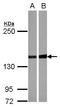 Serine/threonine-protein phosphatase 2A regulatory subunit B subunit alpha antibody, LS-C155388, Lifespan Biosciences, Western Blot image 