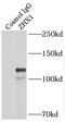 Zinc fingers and homeoboxes protein 1 antibody, FNab09635, FineTest, Immunoprecipitation image 