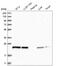 RAB3 GTPase Activating Non-Catalytic Protein Subunit 2 antibody, HPA026273, Atlas Antibodies, Western Blot image 